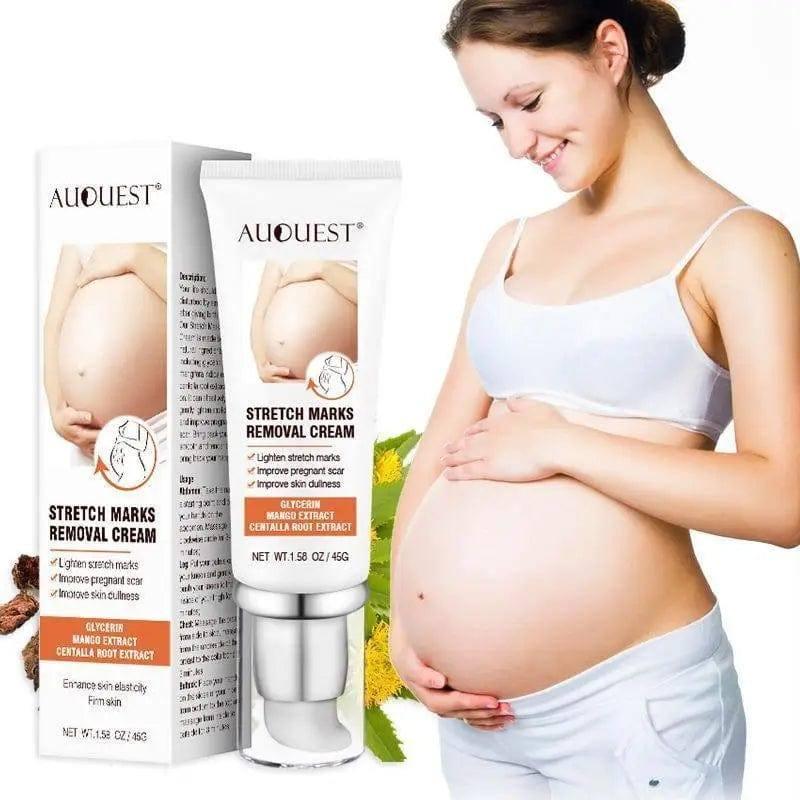 LOVEMI - Lovemi - Remove Pregnancy Scars Acne Cream Stretch Mark